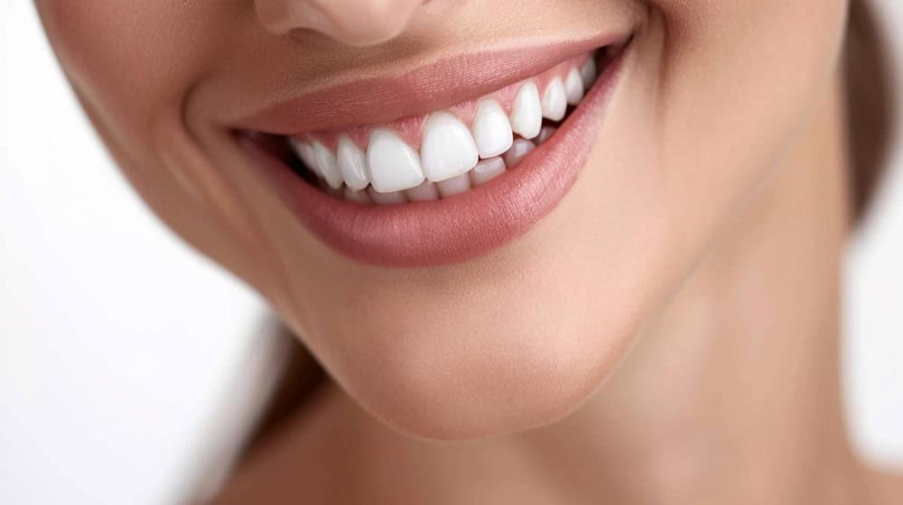 trajtime estetike dentare në Shqipëri