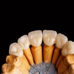 zirconium dental crown