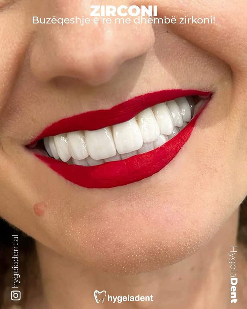 coronas de zirconia en Albania resultados antes y después