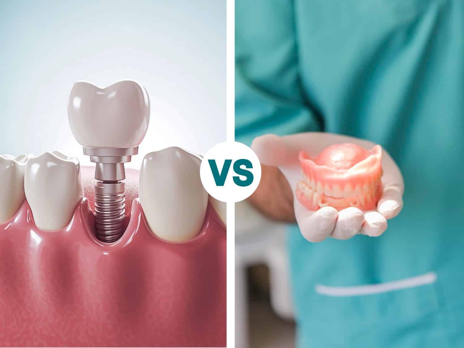 Implante dentare ose proteza të lëvizshme