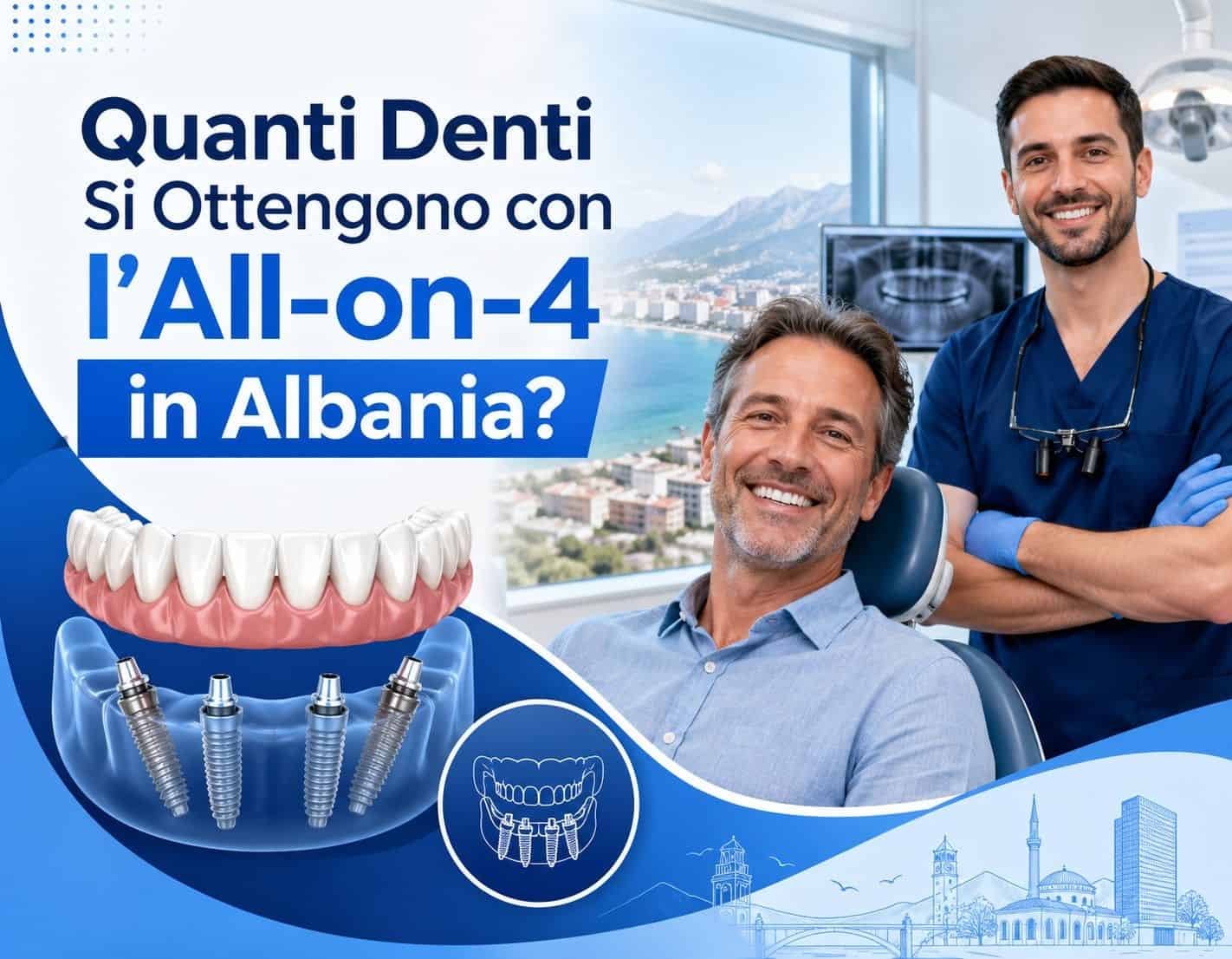 Quanti Denti Si Ottengono con l’All-on-4 in Albania?
