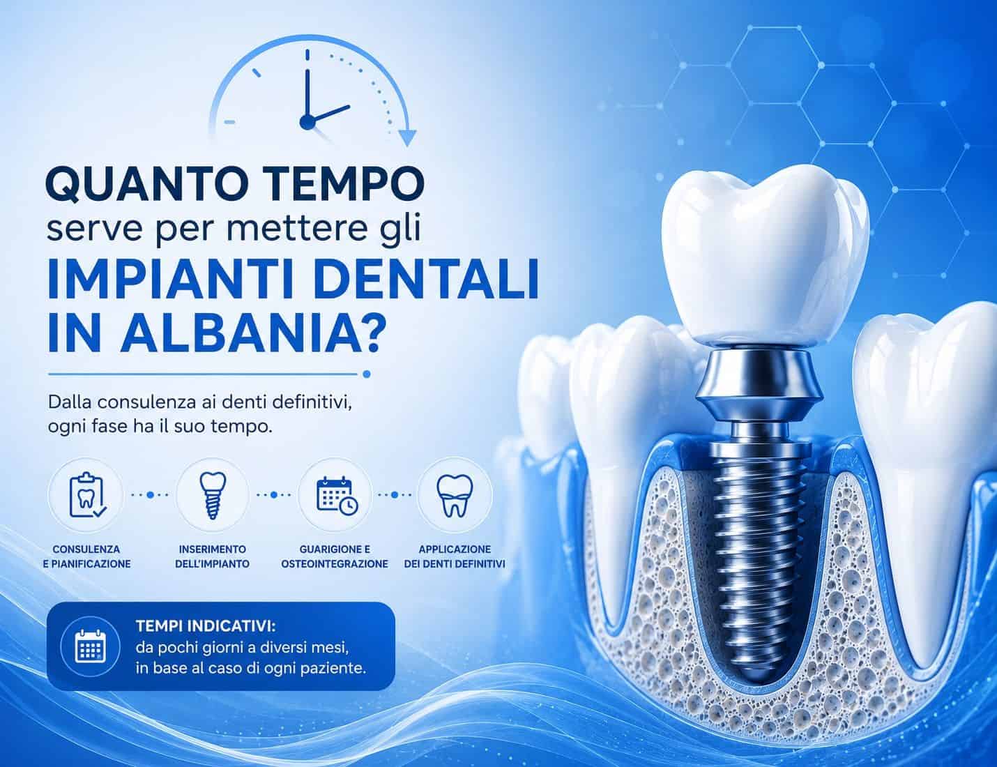 Quanto tempo serve per mettere gli impianti dentali in Albania?