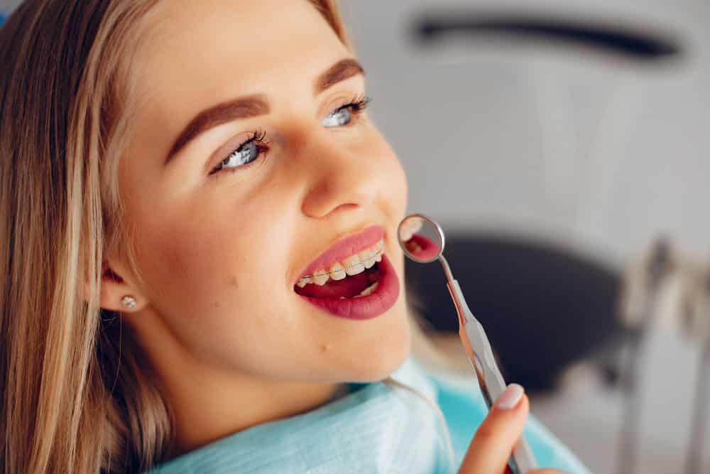 Adult orthodontic braces for aesthetic and oral health in Albania dental clinic.