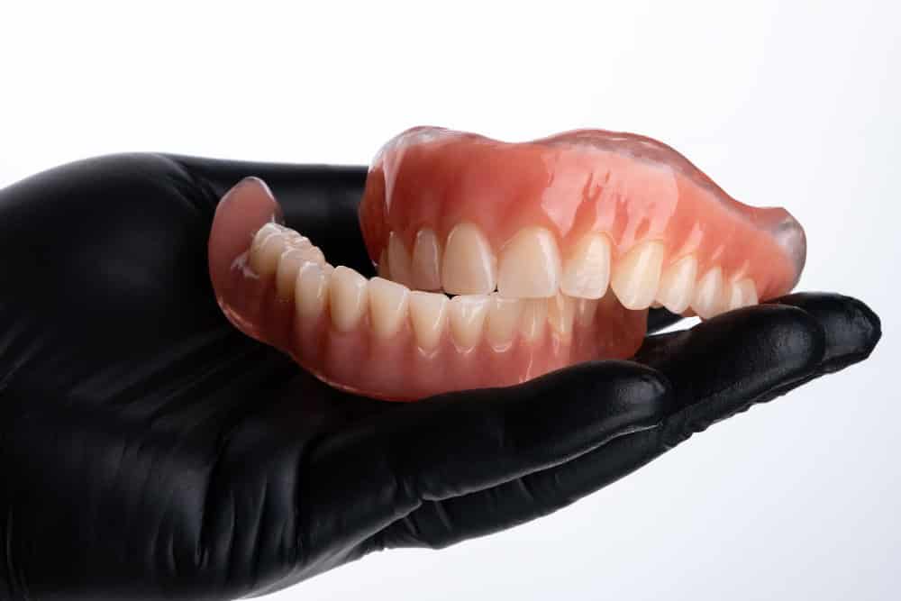 Dental prosthesis for mouth rehabilitation at Albanian dental clinic.
