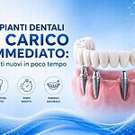 Dental implants in Albania for immediate load and quick teeth restoration.