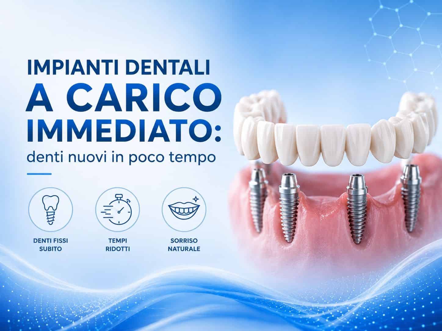 Impianti Dentali a Carico Immediato: Denti Nuovi in Poco Tempo