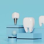 Dental implants and teeth restoration at a top dentist in Albania for optimal oral health.